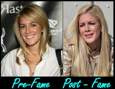 heidi montag before and after 10 surgeries. changing plastic surgery.
